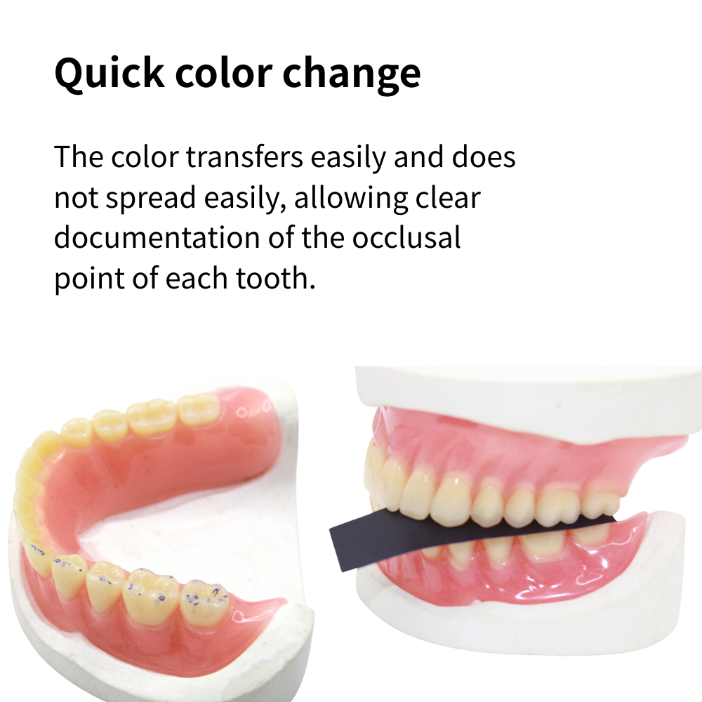 AG 300매/박스 치과용 교합지 레드/블루 치과 기공 - Teeth Whitening Retainer 리뷰 및 가격