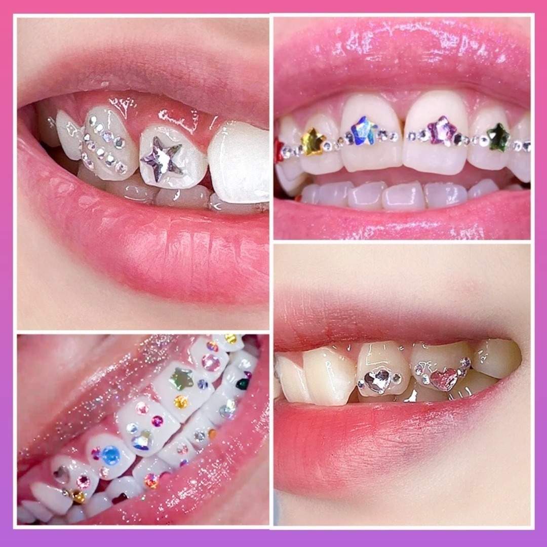 DIY 치아 보석 키트 보석 세트 크리스탈 다이아몬드  - Tooth Gem Kit 리뷰 및 가격