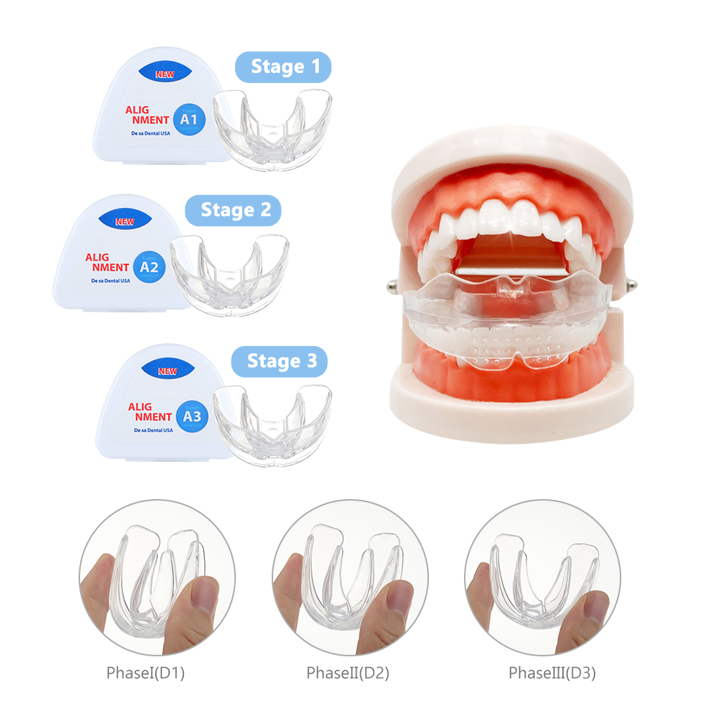 치과 교정 치과 교정기 세트 3 단계 실리콘 정렬 트레 - Teeth Whitening Retainer 리뷰 및 가격