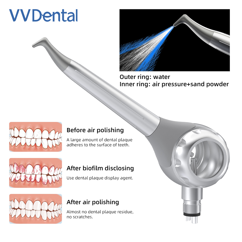 VV 치과용 2/4홀 치아 미백 샌드블라스팅 건 양면  - Teeth Whitening Dental 리뷰 및 가격