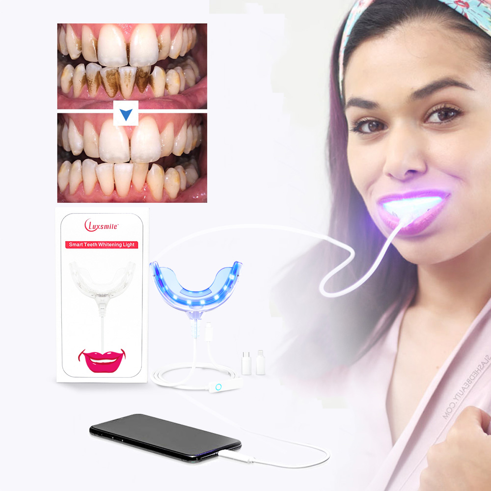Luxsmile 스마트 LED 치아 미백 휴대용 USB - Teeth Whitening Retainer 리뷰 및 가격