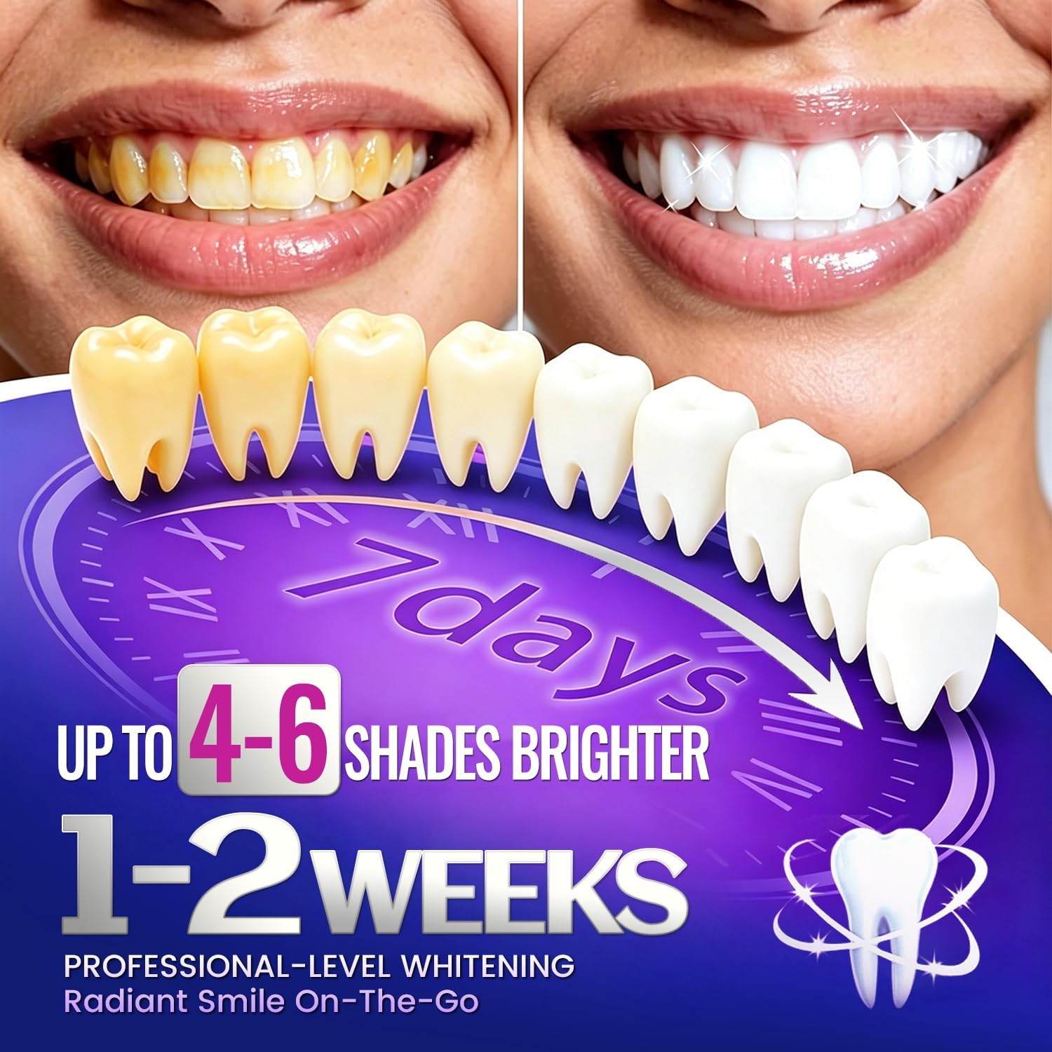 7쌍의 치아 미백 스트립으로 더 하얗게 보이는 미소를  - Teeth Whitening Retainer 리뷰 및 가격