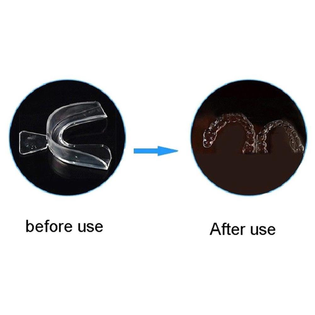 실리콘 마우스가드 교정용 치아 유지 장치 치아 보호대  - Teeth Whitening Retainer 리뷰 및 가격