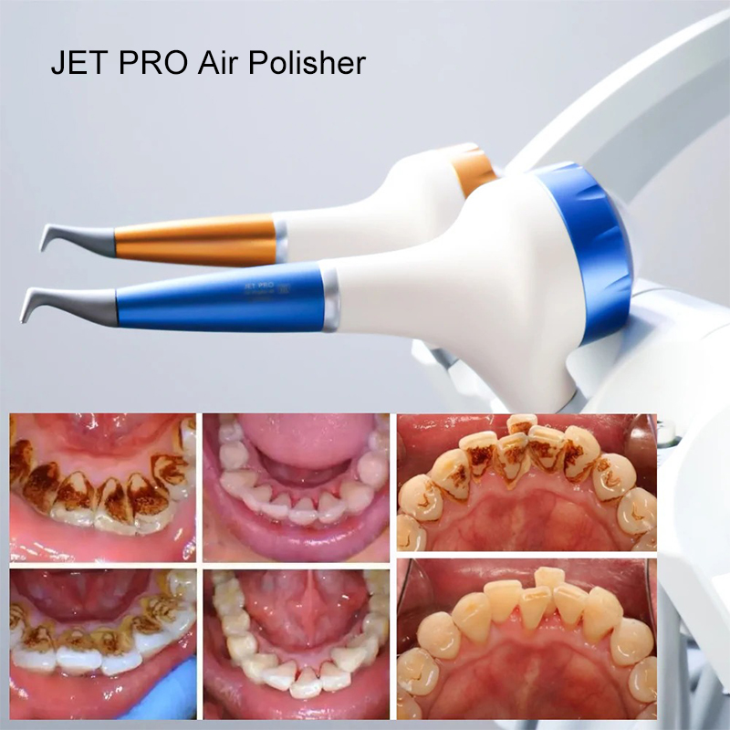 VV 치과용 에어폴리싱 프로피 에어 플로우 구강 위생  - Teeth Whitening Dental 리뷰 및 가격