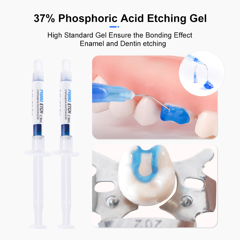 치아 보석 세트 접착제 키트 UV 경화 빛 치과 교정  - Tooth Gem Kit 리뷰 및 가격