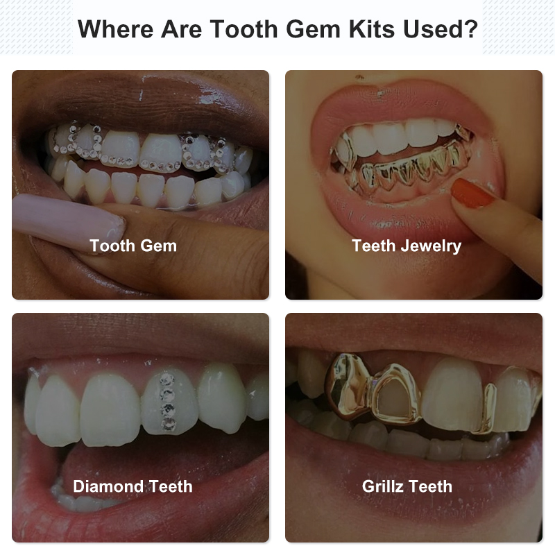 치아 보석 세트 접착제 키트 UV 경화 빛 치과 교정  - Tooth Gem Kit 리뷰 및 가격