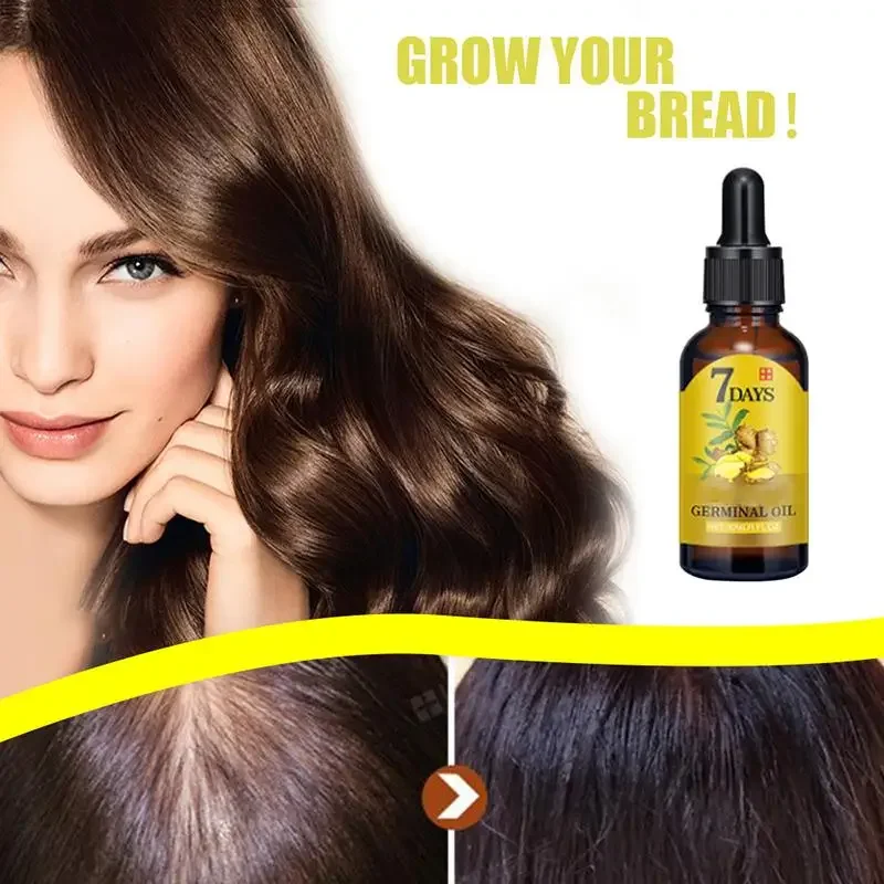 모발 성장 생강 빠르게 성장하는 모발 에센셜 오일 헤어 - Coconut Oil Pull 리뷰 및 가격