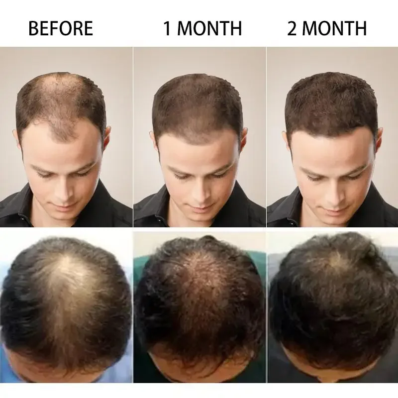 모발 성장 생강 빠르게 성장하는 모발 에센셜 오일 헤어 - Coconut Oil Pull 리뷰 및 가격